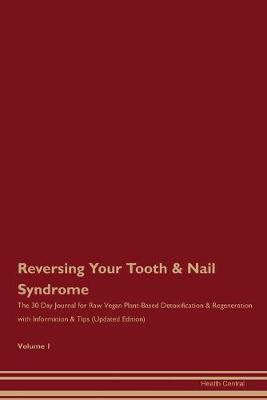 Book cover for Reversing Your Tooth & Nail Syndrome