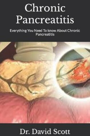 Cover of Chronic Pancreatitis