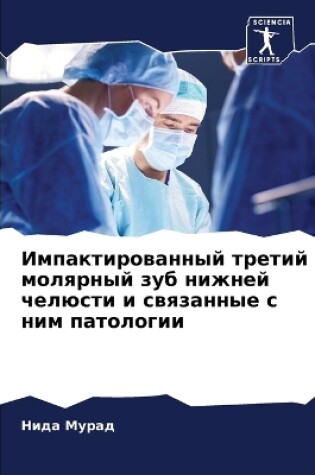 Cover of &#1048;&#1084;&#1087;&#1072;&#1082;&#1090;&#1080;&#1088;&#1086;&#1074;&#1072;&#1085;&#1085;&#1099;&#1081; &#1090;&#1088;&#1077;&#1090;&#1080;&#1081; &#1084;&#1086;&#1083;&#1103;&#1088;&#1085;&#1099;&#1081; &#1079;&#1091;&#1073; &#1085;&#1080;&#1078;&#1085;