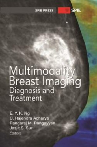 Cover of Multimodality Breast Imaging