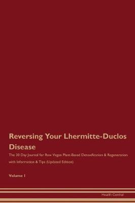 Book cover for Reversing Your Lhermitte-Duclos Disease