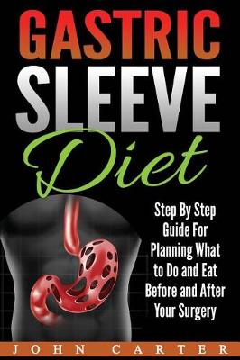 Book cover for Gastric Sleeve Diet