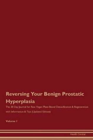 Cover of Reversing Your Benign Prostatic Hyperplasia