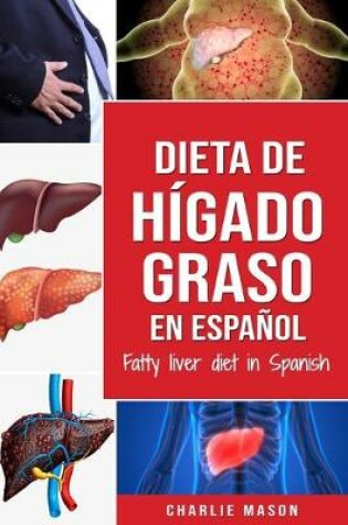 Cover of Dieta de hígado graso en español/Fatty liver diet in Spanish