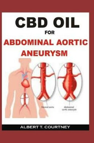 Cover of CBD Oil for Abdominal Aortic Aneurysm