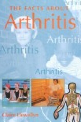 Cover of Arthritis