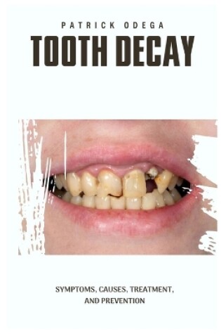 Cover of Tooth Decay