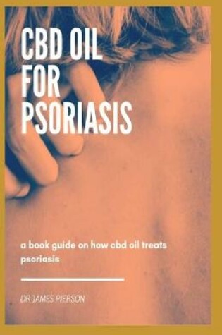 Cover of CBD Oil for Psoriasis