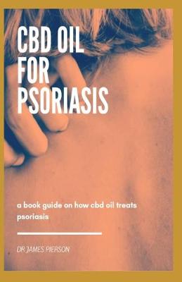 Book cover for CBD Oil for Psoriasis