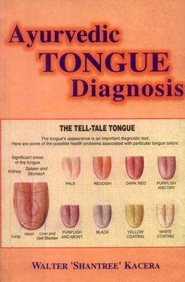 Book cover for Ayurvedic Tongue Diagnosis