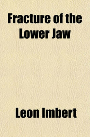 Cover of Fracture of the Lower Jaw