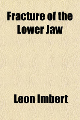 Book cover for Fracture of the Lower Jaw