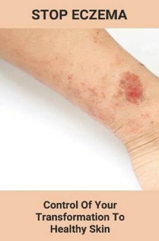 Cover of Stop Eczema