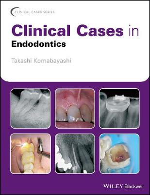 Book cover for Clinical Cases in Endodontics
