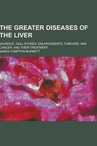 Cover of The Greater Diseases of the Liver; Jaundice, Gall-Stones, Enlargements, Tumours, and Cancer