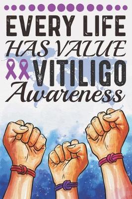 Book cover for Every Life Has Value Vitiligo Awareness