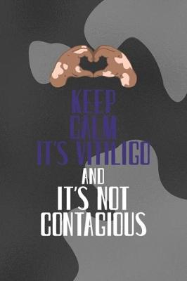 Book cover for Keep Calm It's Vitiligo And It's Not contagious