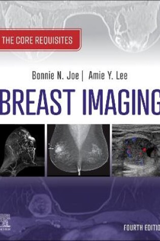 Cover of Breast Imaging, E-Book