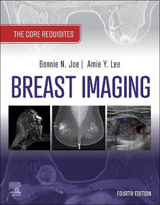 Cover of Breast Imaging, E-Book