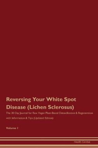 Cover of Reversing Your White Spot Disease (Lichen Sclerosus)