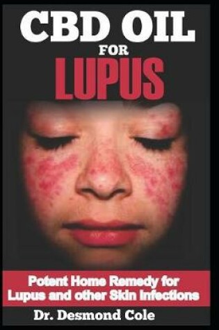 Cover of CBD Oil for Lupus