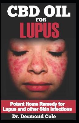 Book cover for CBD Oil for Lupus