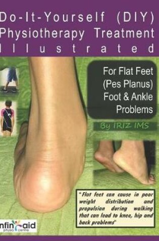 Cover of Physiotherapy Treatment Illustrated For Flat Feet (Pes Planus) Foot & Ankle Problems