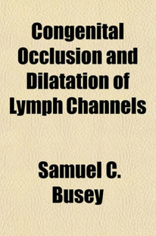 Cover of Congenital Occlusion and Dilatation of Lymph Channels