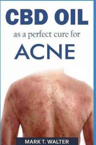 Cover of CBD Oil as a Perfect Cure for Acne