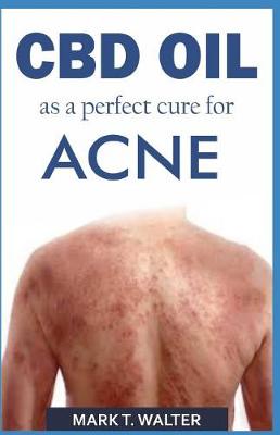 Book cover for CBD Oil as a Perfect Cure for Acne