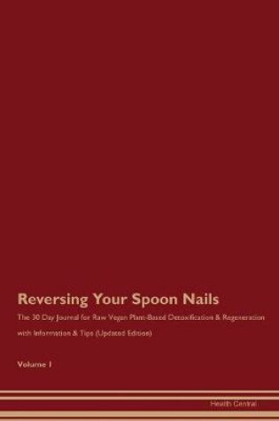 Cover of Reversing Your Spoon Nails