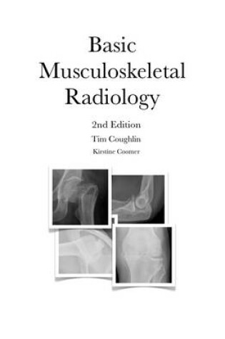 Cover of Basic Musculoskeletal Radiology: 2nd Edition