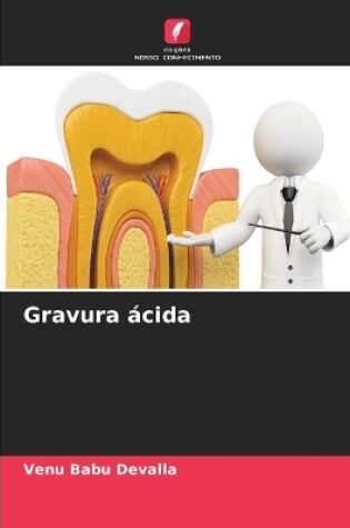 Cover of Gravura ácida