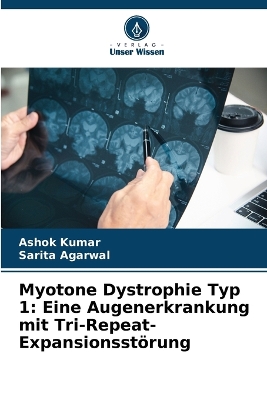 Book cover for Myotone Dystrophie Typ 1