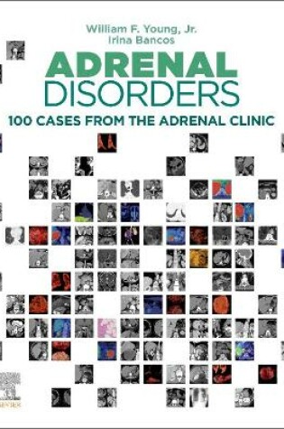 Cover of Adrenal Disorders, E-Book