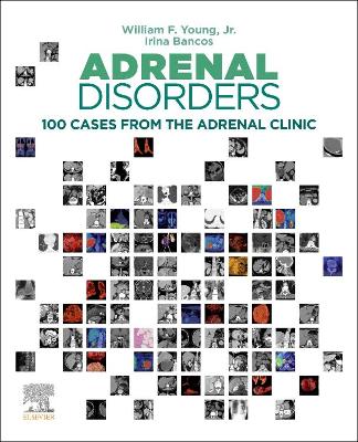 Cover of Adrenal Disorders, E-Book