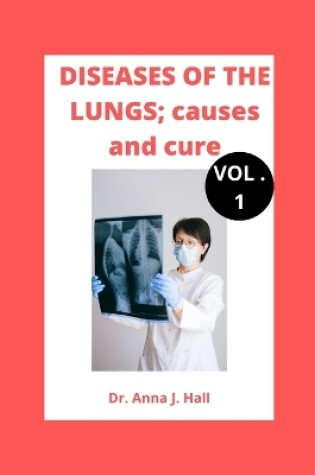 Cover of DISEASES OF THE LUNGS; causes and cure (Vol.1)