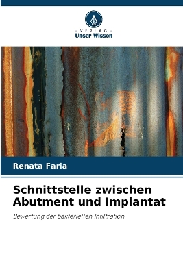 Cover of Schnittstelle zwischen Abutment und Implantat