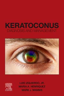 Cover of Keratoconus, E-Book