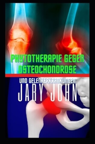 Cover of Phytotherapie gegen Osteochondrose und Gelenkerkrankungen