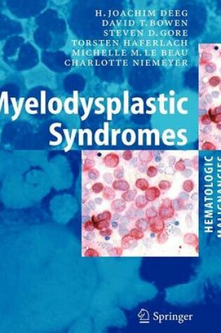 Cover of Myelodysplastic Syndromes