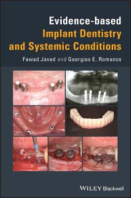 Book cover for Evidence-based Implant Dentistry and Systemic Conditions