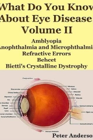 Cover of What Do You Know About Eye Disease; Volume II: Amblyopia, Anophthalmia and Microphthalmia, Refractive Errors, Behcet and Bietti's Crystalline Dystrophy