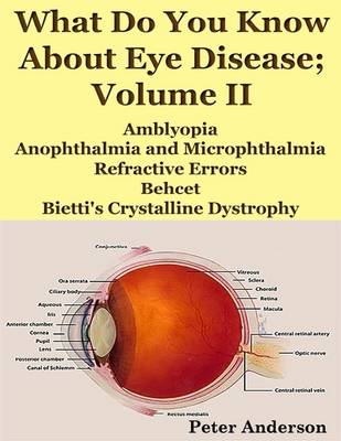 Book cover for What Do You Know About Eye Disease; Volume II: Amblyopia, Anophthalmia and Microphthalmia, Refractive Errors, Behcet and Bietti's Crystalline Dystrophy