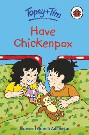 Cover of Have Chickenpox