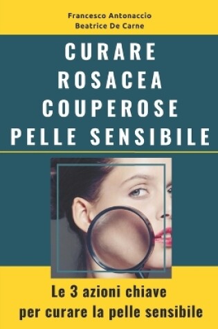 Cover of Curare Rosacea Couperose e Pelle Sensibile