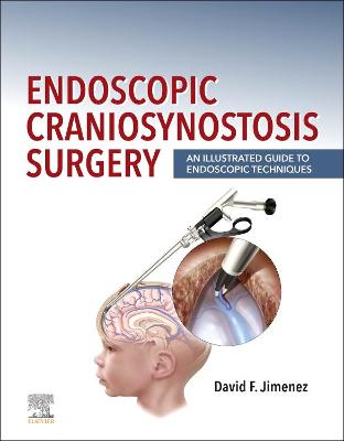 Book cover for Endoscopic Craniosynostosis Surgery E-Book
