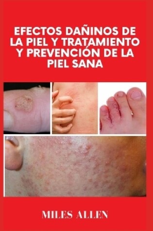 Cover of Efectos Dañinos de la Piel Y Tratamiento Y Prevención de la Piel Sana