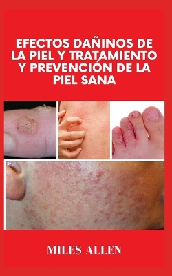 Book cover for Efectos Dañinos de la Piel Y Tratamiento Y Prevención de la Piel Sana