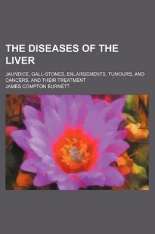 Cover of The Diseases of the Liver; Jaundice, Gall-Stones, Enlargements, Tumours, and Cancers, and Their Treatment